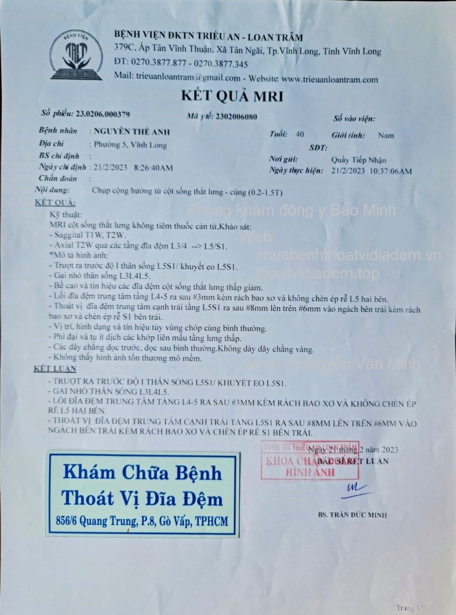 Thoát vị đĩa đệm rách bao xơ